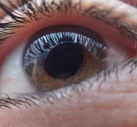 Glaucoma oculare