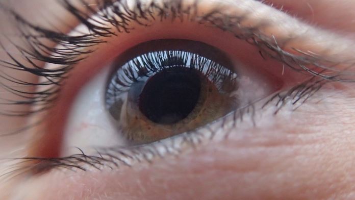 Glaucoma oculare